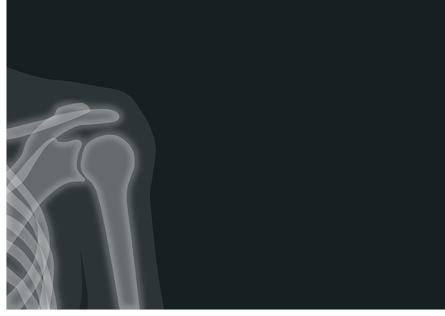 x-ray-of the shoulder (kamabeka in bukusu langauge)